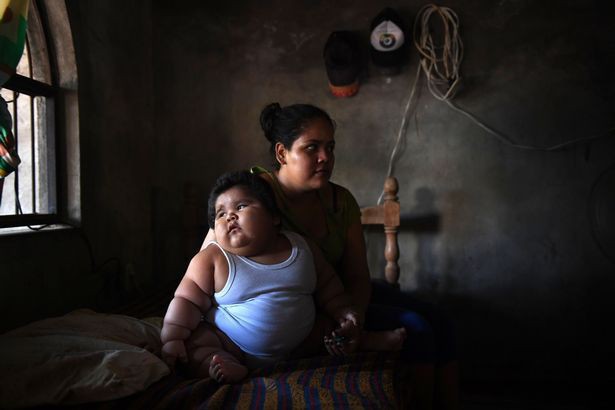 Con 10 tháng nặng 28kg, mẹ đinh ninh con hấp thu sữa mẹ tốt mà không ngờ có thể mắc bệnh đặc biệt - Ảnh 5.