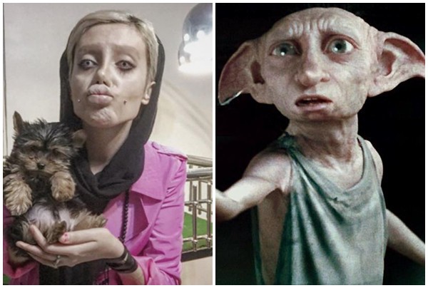 Cô gái phẫu thuật thẩm mỹ hơn 50 lần để nhìn giống Angelina Jolie, kết quả trả về gia tinh Dobby - Ảnh 5.