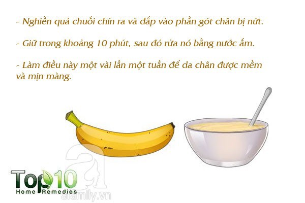 7 mẹo hàng đầu giúp bạn không bị nhiễm trùng và nứt gót chân trong mùa đông này - Ảnh 5.