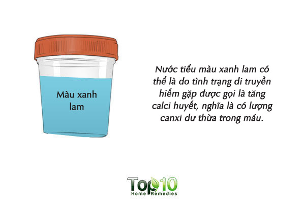 Màu sắc của nước tiểu cảnh báo tình trạng sức khỏe của bạn - Ảnh 8.