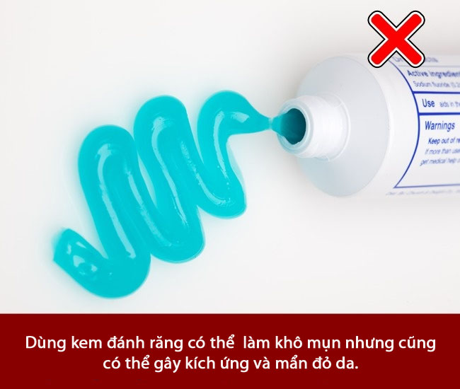 6 sai lầm khi trị mụn trứng cá khiến mụn mọc nhiều hơn và hủy hoại làn da bạn nhanh chóng - Ảnh 7.