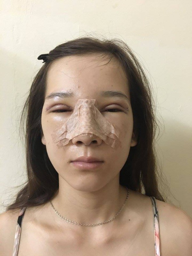 Màn lột xác bất ngờ của nữ sinh ĐH Y khoa Vinh từng bị nhà người yêu từ chối vì có đôi mắt lươn - Ảnh 8.