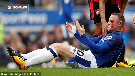 Bị đổ máu trên sân, Rooney bức xúc “kêu oan” với trọng tài - Ảnh 1.
