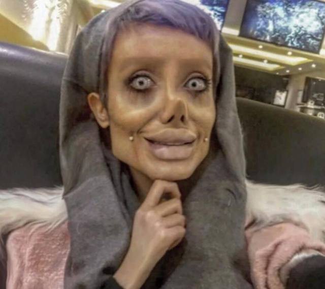 Having undergone surgery 50 times to look like Angelina Jolie, the young girl looks terrified like a zombie - Photo 6.
