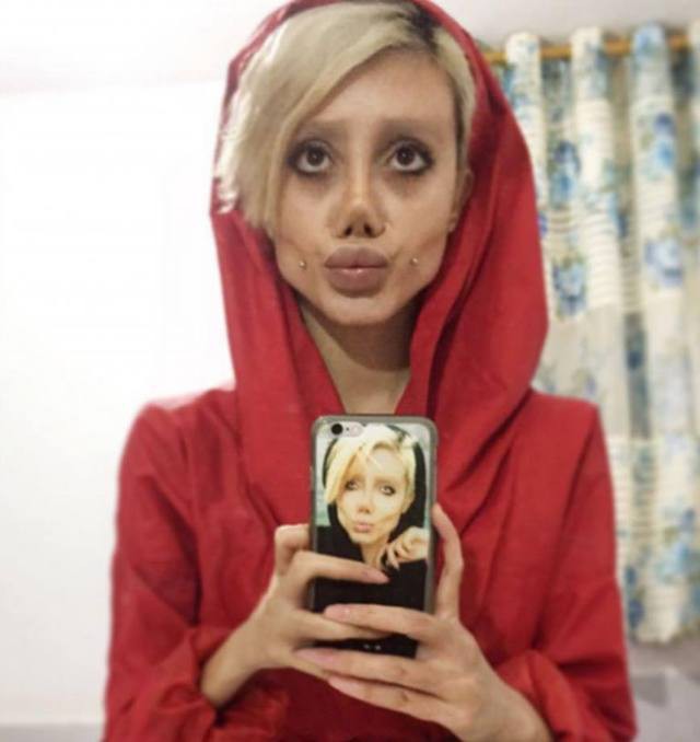 Having undergone surgery 50 times to look like Angelina Jolie, the young girl looks terrified like a zombie - Photo 11.