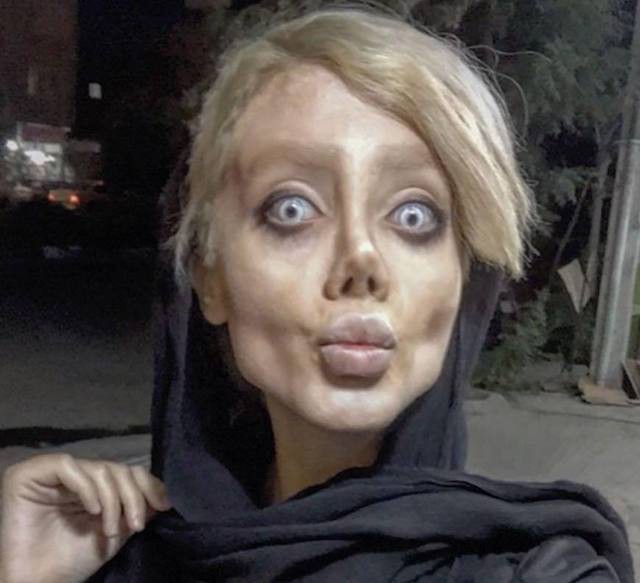 Having undergone surgery 50 times to look like Angelina Jolie, the young girl looks terrified like a zombie - Photo 10.