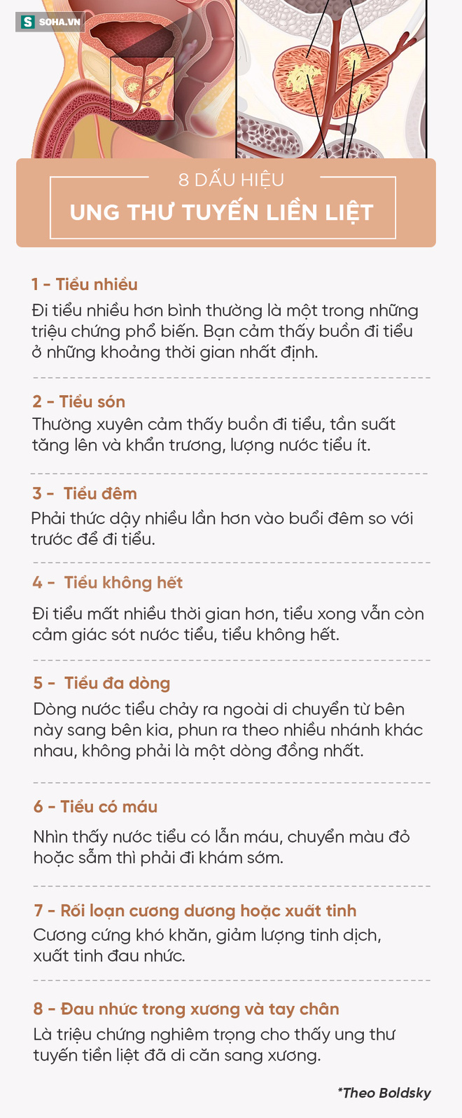 [Đọc nhanh] 8 dấu hiệu cảnh báo ung thư tuyến tiền liệt, mọi quý ông đều nên đề phòng - Ảnh 2.