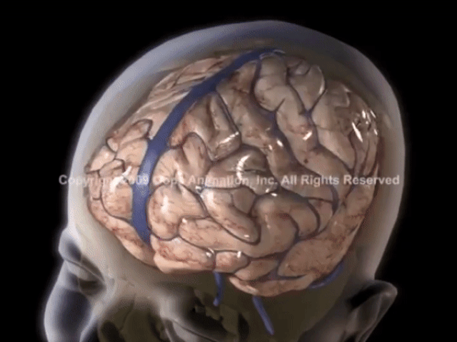 Hình ảnh cho thấy rung lắc gây tác hại đến não trẻ thế nào, dù chỉ 5 giây - Ảnh 2.