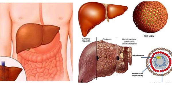 Những chỉ điểm báo hiệu bạn có thể bị ung thư gan - Ảnh 1.