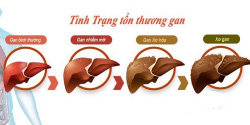 Ðừng để rượu tàn phá gan - Ảnh 1.