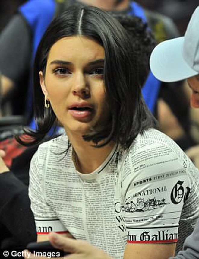 Hậu bơm môi sửa mặt, Kendall Jenner bắt đầu xuống sắc vì di chứng thẩm mỹ? - Ảnh 5.