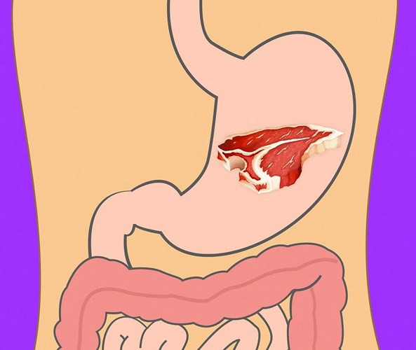 Mất bao lâu để tiêu hóa hết thực phẩm ăn hàng ngày? - Ảnh 14.