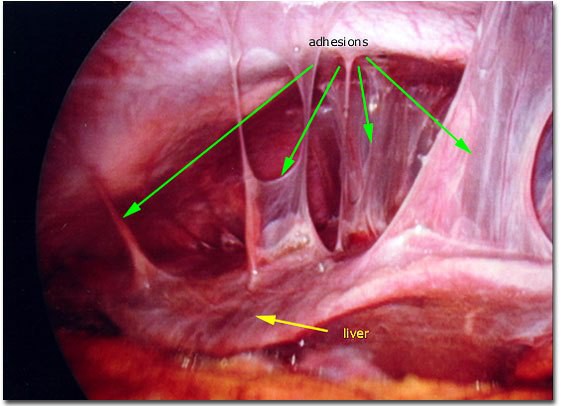 Viêm gan do loại vi khuẩn lây qua đường quan hệ tình dục nhiều người còn thờ ơ - Ảnh 1.