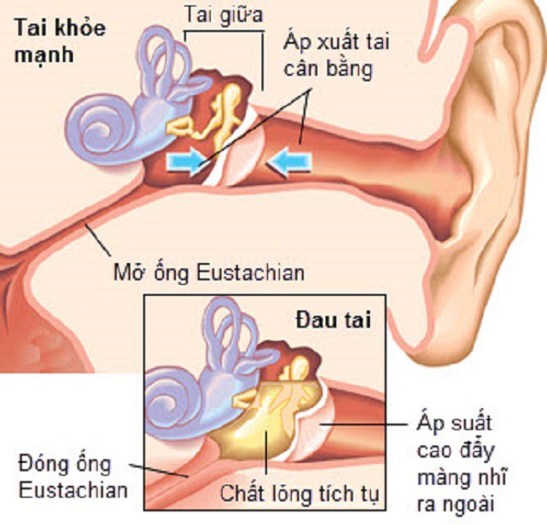 Căn bệnh có tỷ lệ người mắc cao nhất tại VN: Không khí càng ô nhiễm, càng nhiều người mắc - Ảnh 2.