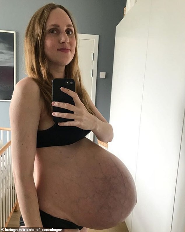 Bà mẹ sinh ba có bụng bầu dài bất thường lại gây sốt với vòng hai như chưa đẻ sau khi sinh 1 tháng - Ảnh 3.