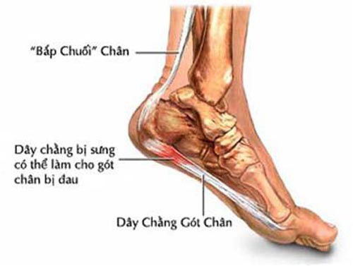 Sự thật sau những cơn đau ở gót chân - Ảnh 1.