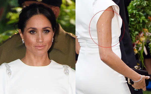 Meghan bị soi cánh tay bóng nhẫy như bôi mỡ, thực chất đây là lý do khiến ai cũng bất ngờ - Ảnh 1.