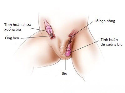 Xử lý các bất thường hay gặp ở vùng kín bé trai - Ảnh 1. Xử lý các bất thường hay gặp ở vùng kín bé trai - Ảnh 1.