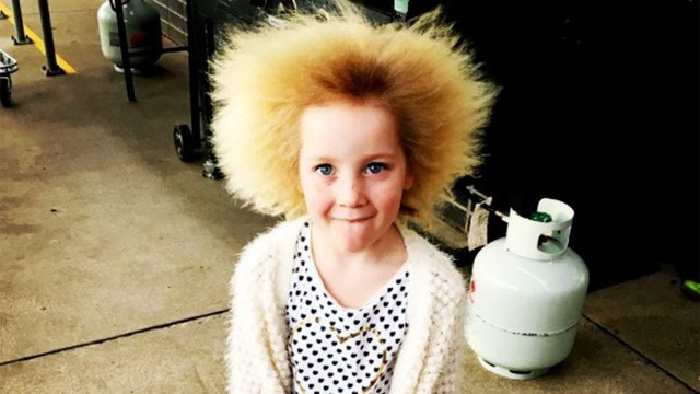 Kỳ lạ bé gái 8 tuổi có mái tóc dựng đứng giống nhà bác học thiên tài Albert Einstein - Ảnh 1.