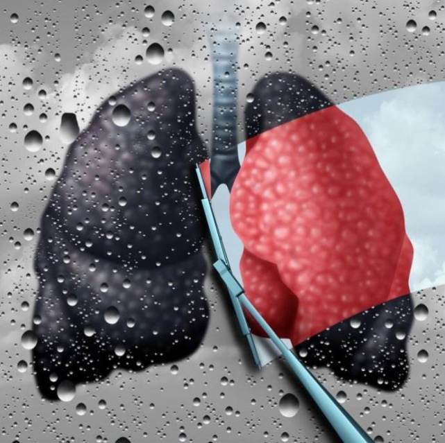 5 thực phẩm được ví là máy hút bụi cho phổi: Thường xuyên ăn, phổi sẽ được dọn sạch sẽ - Ảnh 1.