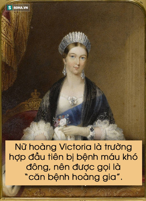 Điều chưa biết về Nữ hoàng Victoria (P4): Hay nằm sấp khi ngủ - Ảnh 2.