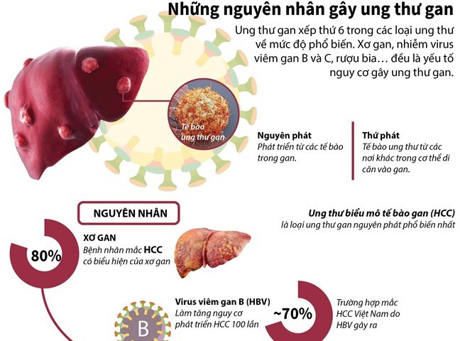 Tại sao đa số người ung thư gan đều tử vong: Biết sớm điều này sẽ vượt qua cửa tử dễ hơn - Ảnh 1.