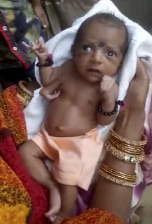 Bé gái Ấn Độ chào đời với 3 bàn tay được người dân tôn thờ như một vị thần - Ảnh 1.