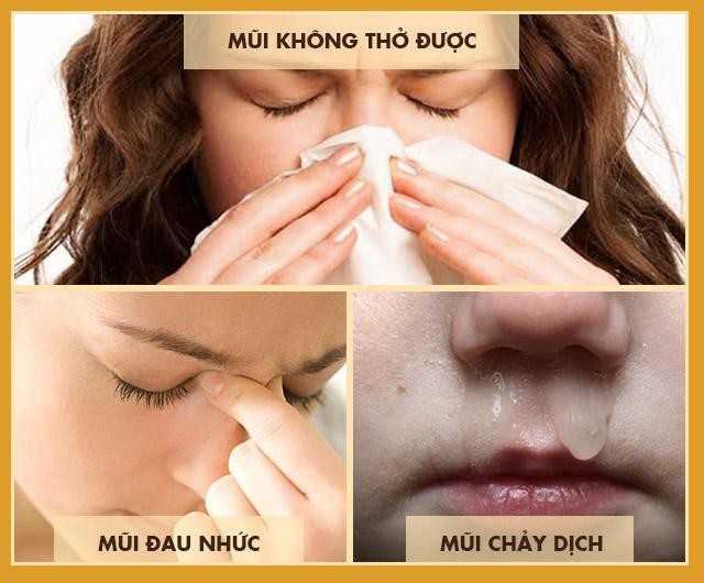 Bệnh viêm xoang và cách chữa hiệu quả không cần đến kháng sinh - Ảnh 1. Bệnh viêm xoang và cách chữa hiệu quả không cần đến kháng sinh - Ảnh 1.