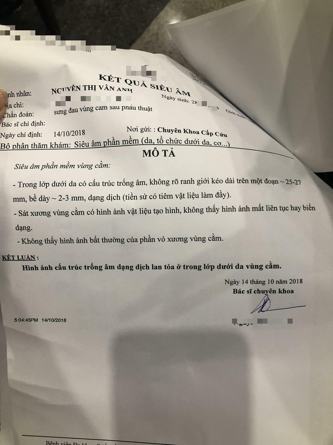 Cô gái trẻ phải tháo độn cằm vì biến chứng do tiêm chất làm đầy từ 4 năm trước: Mình vẫn đang băng nẹp, không biết tháo ra sẽ thế nào... - Ảnh 3.