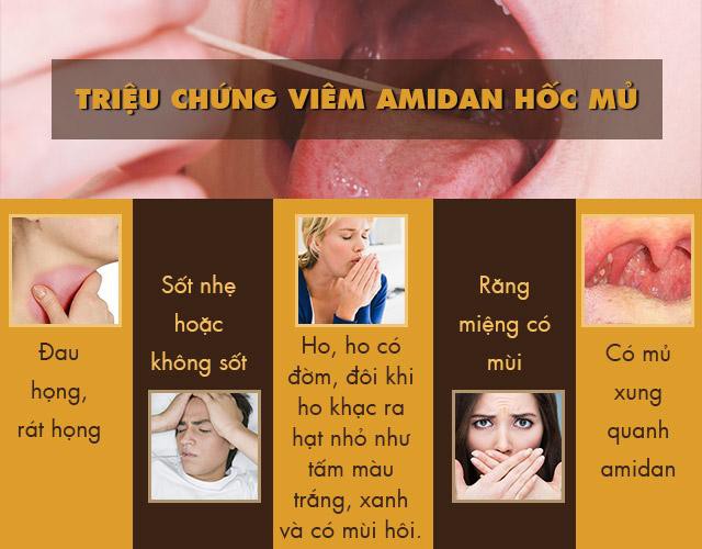 Bệnh viêm amidan hốc mủ: Dấu hiệu và cách chữa hiệu quả  - Ảnh 2.