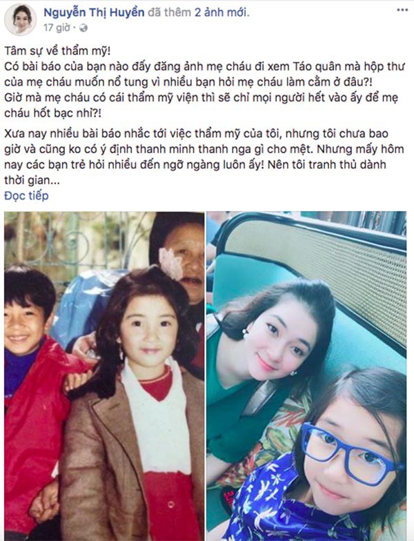 Bị nghi dao kéo, Hoa hậu Nguyễn Thị Huyền: Cằm lẹm là di truyền nhà em nhé! - Ảnh 1.