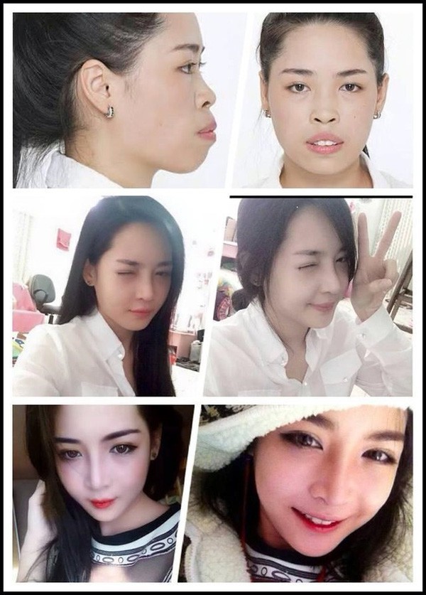 Hot girl thẩm mỹ Vũ Thanh Quỳnh sau 3 năm lột xác: Tôi chưa dám yêu ai, bởi không biết họ mến mình vì gương mặt hay tính cách  - Ảnh 1.