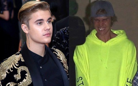 Hành trình lao dốc nhan sắc của Justin Bieber: Hoàng tử Baby năm xưa giờ đây mặt mũi xám xịt, mụn nổi chi chít - Ảnh 23.