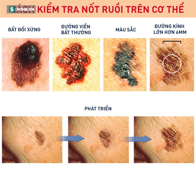 Đang xem tivi về giết người, một phụ nữ báo dấu vết lạ trên cổ khiến sau này MC nói cảm ơn - Ảnh 3.