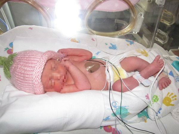 BS cảnh báo: Trẻ sơ sinh có dấu hiệu phồng vùng bẹn, cần khám để phẫu thuật ngay  - Ảnh 1.