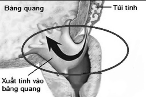 Cách giữ “lửa yêu” ở người đái tháo đường - Ảnh 2.