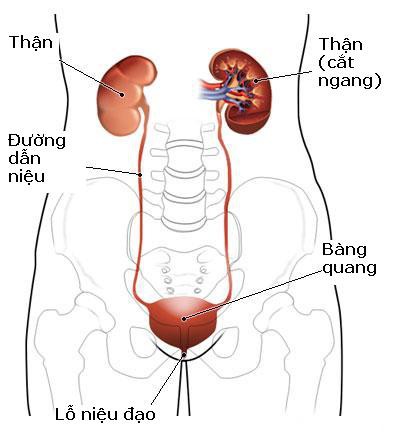 Dấu hiệu báo nhiễm trùng đường tiểu: Phát hiện sớm để ngừa suy thận và nhiễm trùng máu - Ảnh 1.