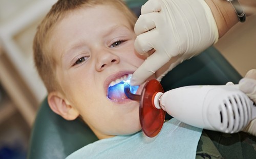 5 quan niệm sai lầm khiến trẻ bị hỏng răng ngay từ nhỏ, các bậc cha mẹ cần chú ý - Ảnh 4.