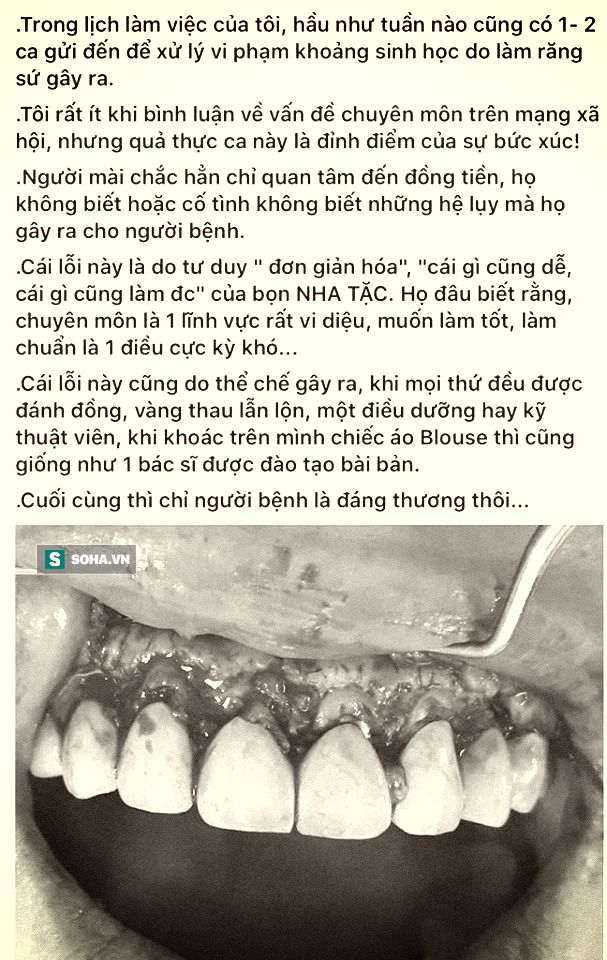 Bác sĩ BV Răng hàm mặt Trung ương chỉ rõ 3 biến chứng đáng sợ của răng sứ thẩm mỹ - Ảnh 1.