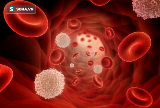Bác sĩ Viện Huyết học và Truyền máu TƯ chỉ ra 6 dấu hiệu sớm của bệnh ung thư máu - Ảnh 1.