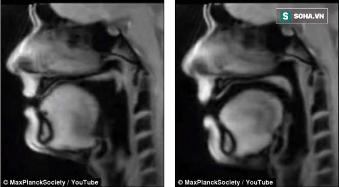 Lần đầu tiên trong lịch sử, nhìn thấu lục phủ ngũ tạng chuyển động khi ta nói, hát - Ảnh 3.