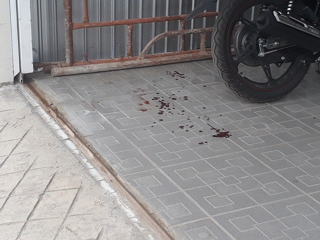 Nổ súng khiến hai người bị thương ở Đà Lạt - Ảnh 3.