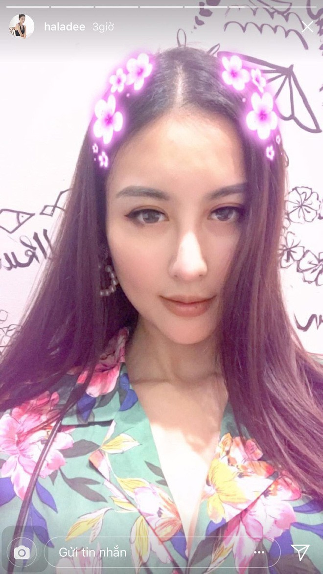 Những người đẹp Vbiz đang mải miết chạy đua với mốt cằm dài nhọn hoắt - Ảnh 24.