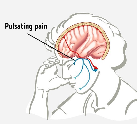 Dấu hiệu cho thấy những người này không thể uống rượu - Ảnh 5.