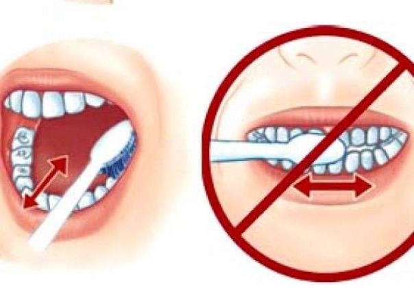 Thói quen đánh răng sai 90% người mắc phải: Làm ướt bàn chải trước khi đánh răng - Ảnh 3.