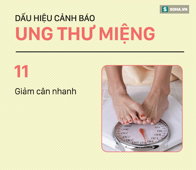 [PHOTO STORY] Đừng nhầm lẫn với bệnh ở miệng, đây là những dấu hiệu cảnh báo ung thư mà bạn nên nhớ - Ảnh 11.