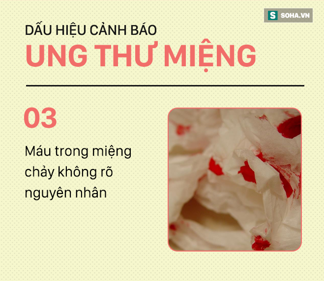 [PHOTO STORY] Đừng nhầm lẫn với bệnh ở miệng, đây là những dấu hiệu cảnh báo ung thư mà bạn nên nhớ - Ảnh 3.