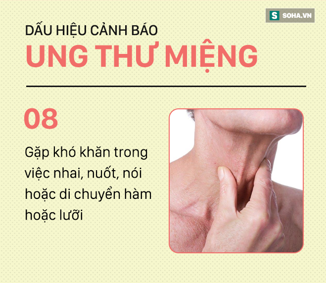 [PHOTO STORY] Đừng nhầm lẫn với bệnh ở miệng, đây là những dấu hiệu cảnh báo ung thư mà bạn nên nhớ - Ảnh 8.