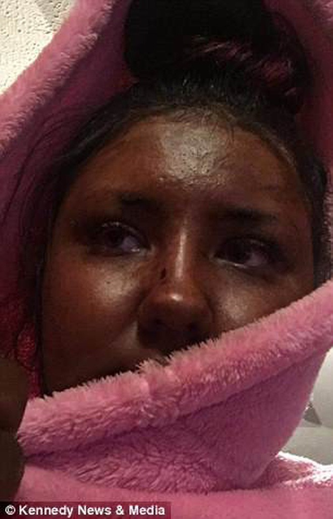 Sử dụng sản phẩm nhuộm da tạm thời, cô gái bỗng đổi màu sang xanh lá cây như người khổng lồ xanh Hulk - Ảnh 2. Sử dụng sản phẩm nhuộm da tạm thời, cô gái bỗng đổi màu sang xanh lá cây như người khổng lồ xanh Hulk - Ảnh 2.