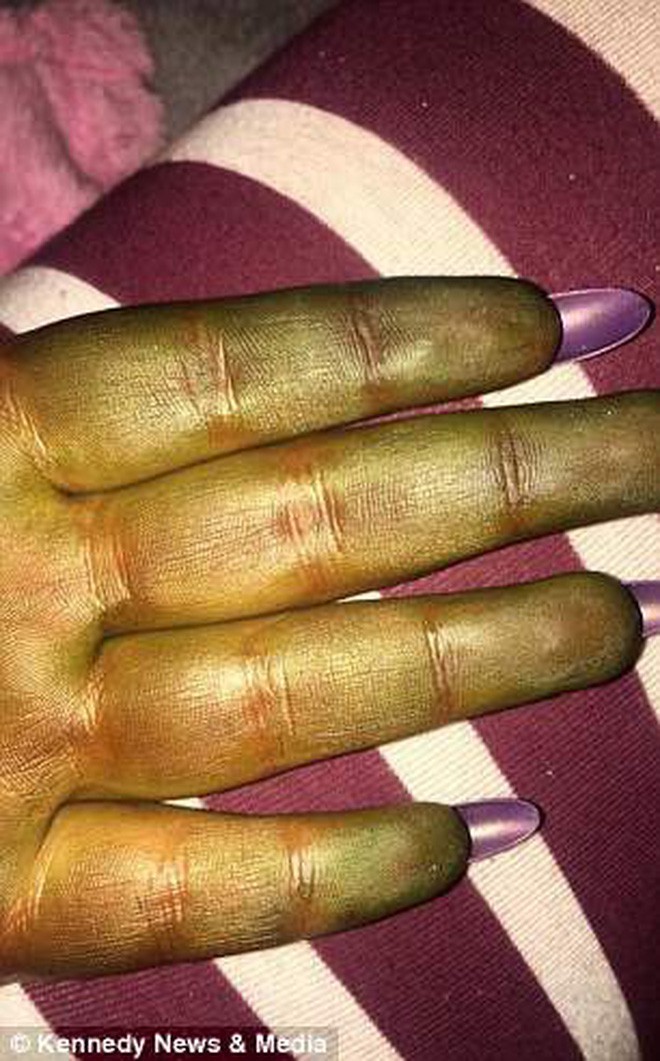 Sử dụng sản phẩm nhuộm da tạm thời, cô gái bỗng đổi màu sang xanh lá cây như người khổng lồ xanh Hulk - Ảnh 5. Sử dụng sản phẩm nhuộm da tạm thời, cô gái bỗng đổi màu sang xanh lá cây như người khổng lồ xanh Hulk - Ảnh 5.